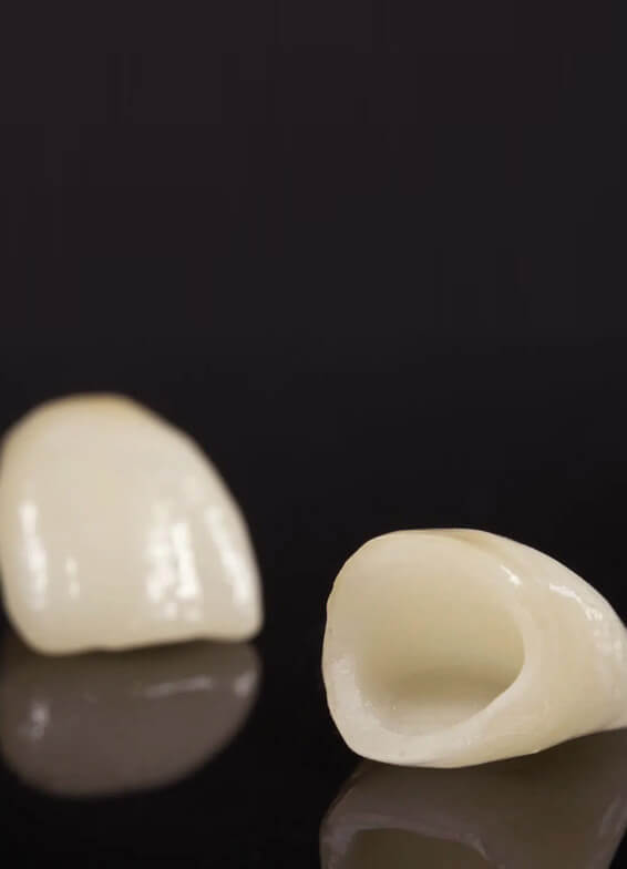 Two dental crowns displayed against dark background, showing exterior and interior views of ceramic tooth restoration.