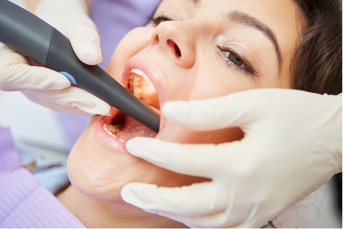 Emergency Root Canal by Van Dentist
