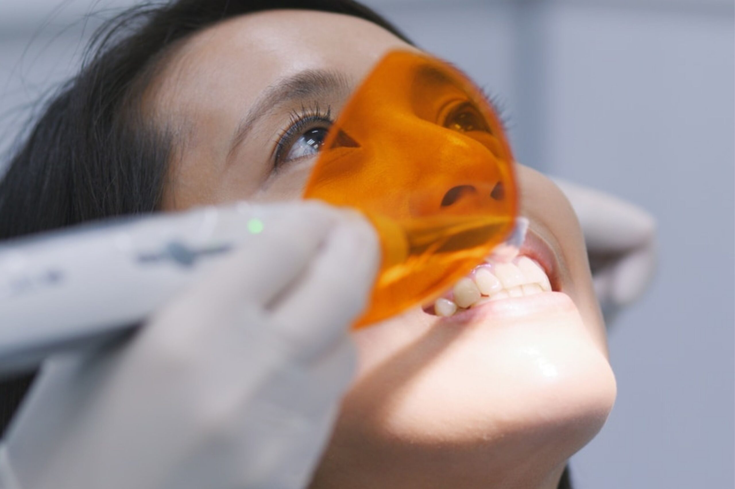 metal free restorations being done on the teeth - Dental Fillings in Van, TX
