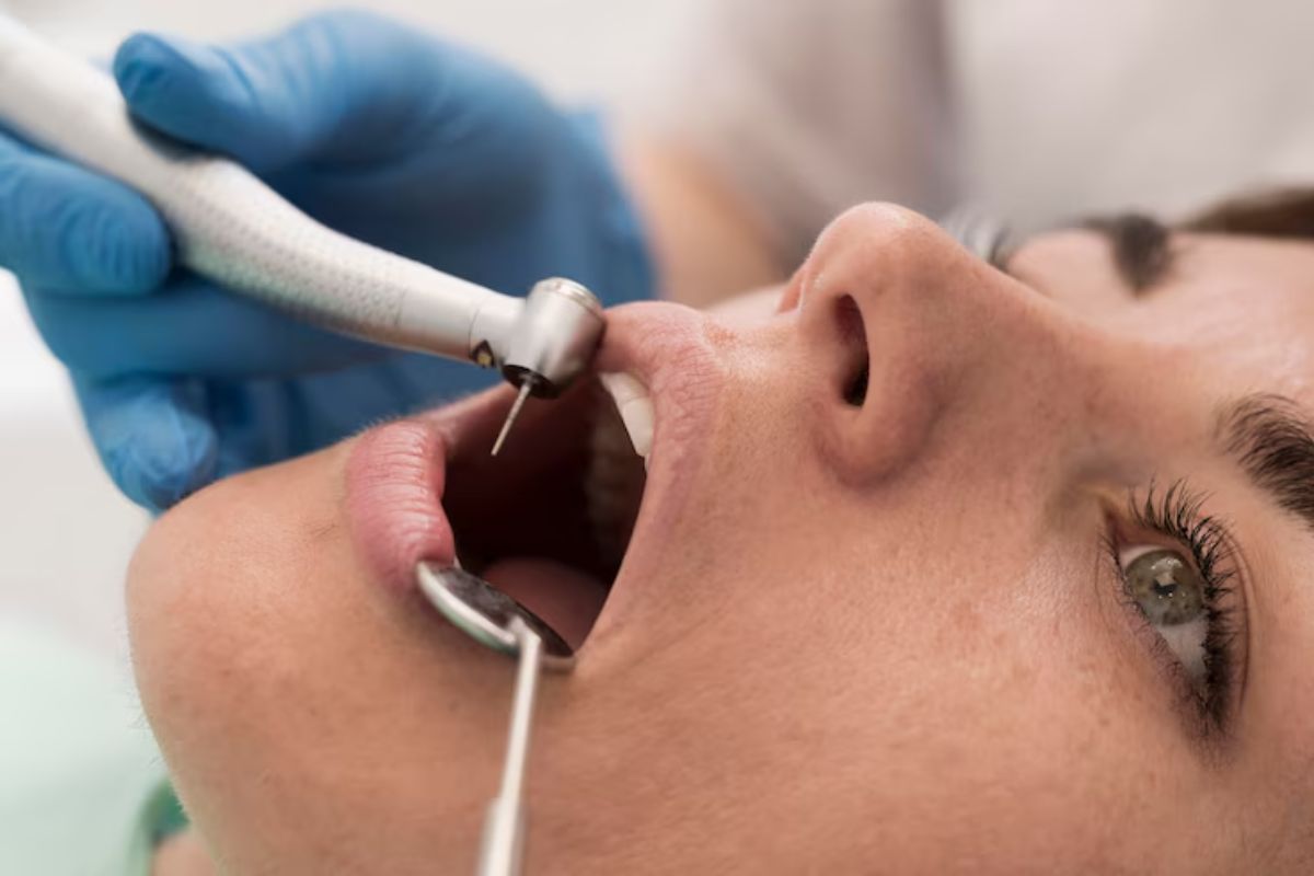 Gingivectomy in Blackwell, OK