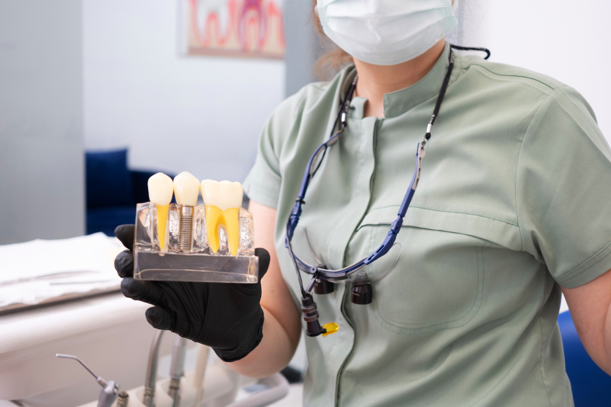 dental implants