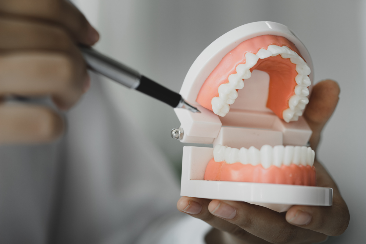 implant dentures