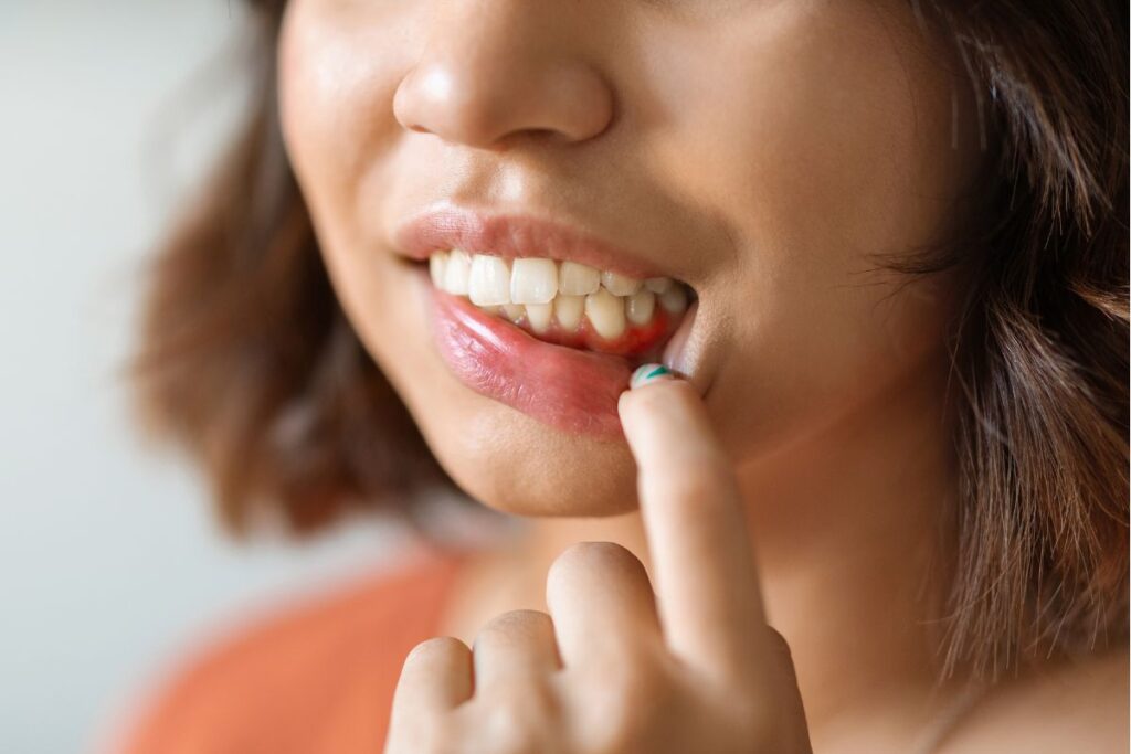 Can You Get Dental Implants with Gum Disease? Woman showing swollen gums during a dental health check