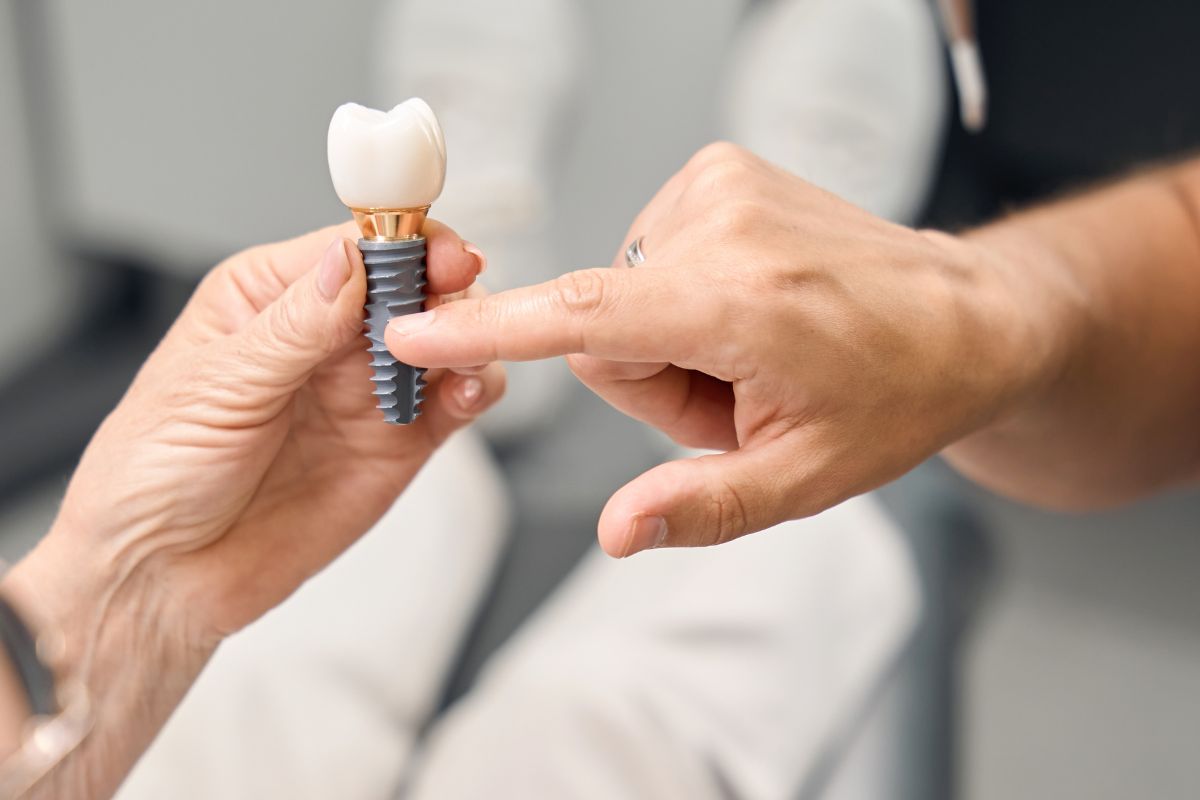 Dental implant model showing an implant post, abutment, and dental crown